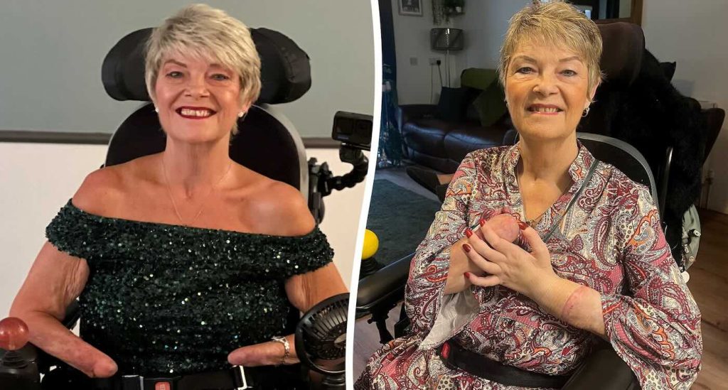 amputee-thrilled-with-hand-transplant-is-now-left-handed:-‘feels-so-incredible,-as-if-i’ve-had-it-my-whole-life’