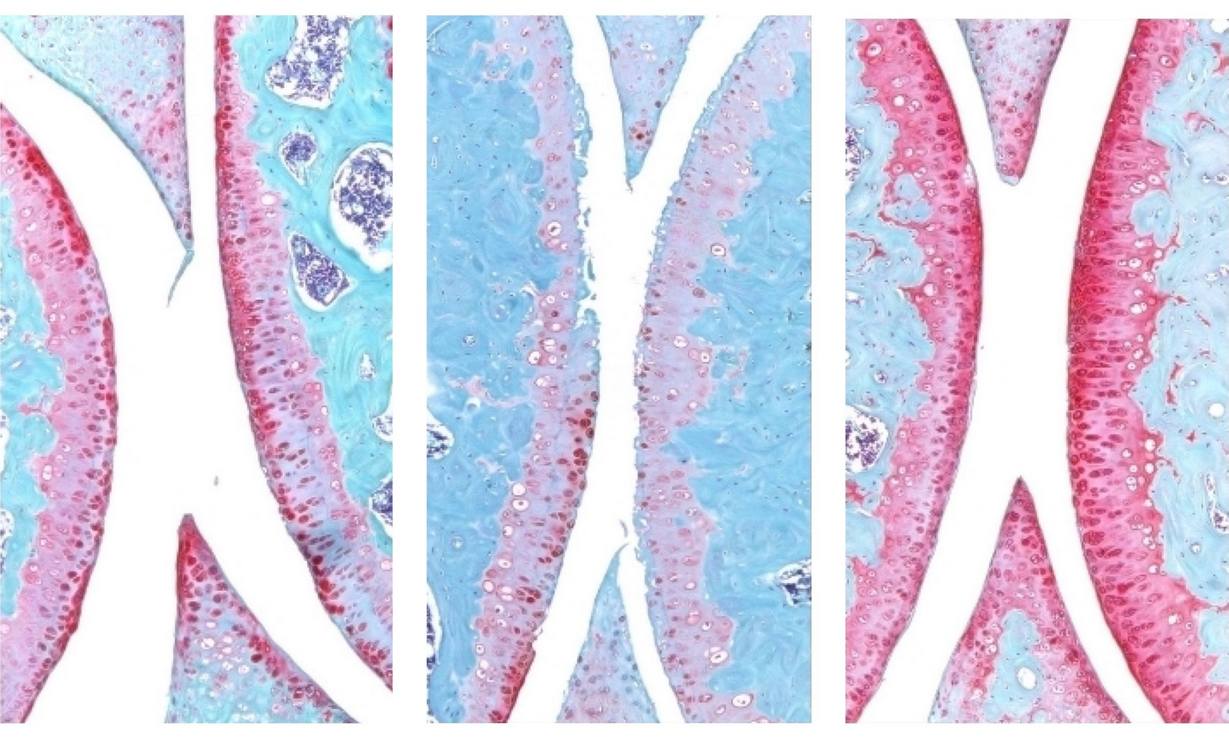 anti-aging-drug-regrows-knee-cartilage-in-major-breakthrough-that-could-end-knee-replacements